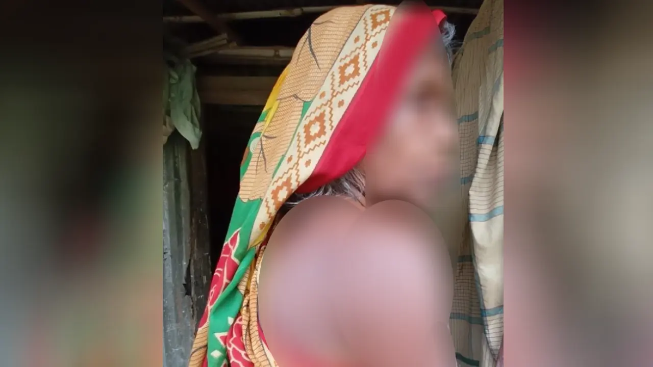 ৫৫ বছর ধরে শরীরে পাকিস্তানি বাহিনীর গুলি, চিকিৎসার অপেক্ষায় যুদ্ধাহত রশিদা আক্তার