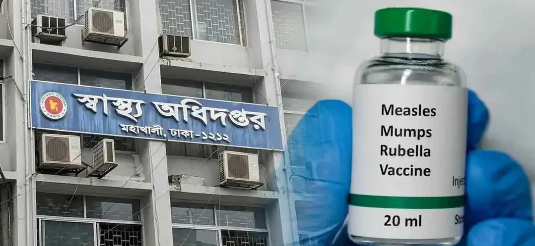 ২৪ ঘণ্টায় হাম উপসর্গে আরও ৫ মৃত্যু, হাসপাতালে ১৩৪২ রোগী